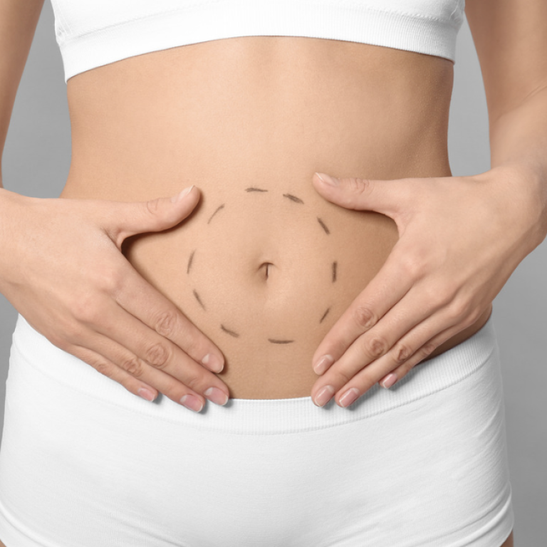 Mini Tummy Tuck Best Prices Near Fairfax VA